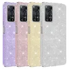 Xiaomi Redmi Note 12 Pro 4G Kılıf Shining Silikon