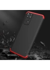 More TR Xiaomi Redmi Note 11S Global Kılıf Zore Ays Kapak