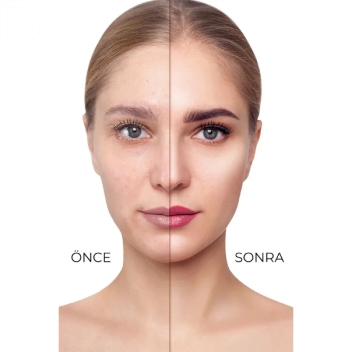 Nevamel® 3lü Mat Bitişli Likit Fondöten Seti