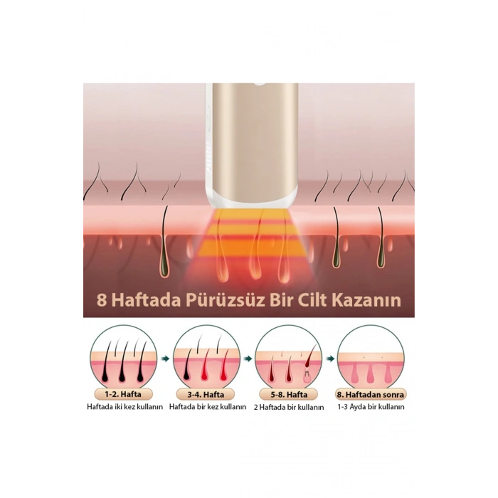 Nevamel EZERE IPL Buz Lazer Epilasyon 999.999 Atim Otomatik/manuel Dokunmatik Ekran Agrisiz Vücut Yüz Cihazi-(5775)