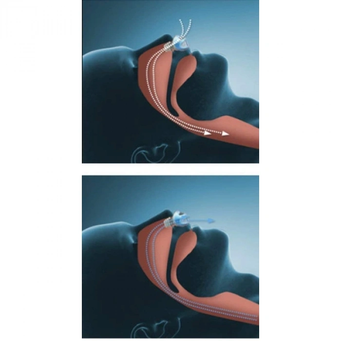 Nevamel® Horlama Önleyici Rahat Uyku Aparatı