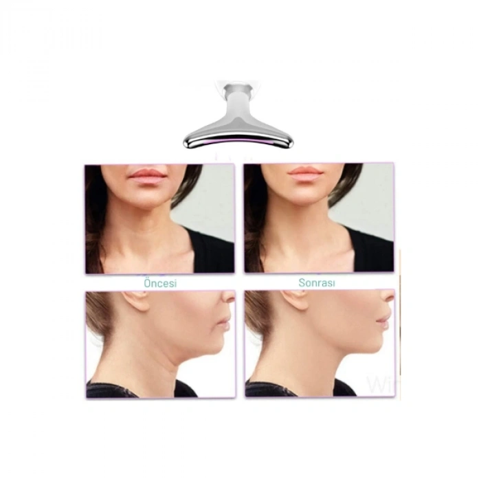 Nevamel Kırışıklık Giderici Masaj Cihazı