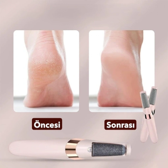 Nevamel Şarjlı Ayak Törpüsü - Pedikür ve Ayak Bakım Aleti