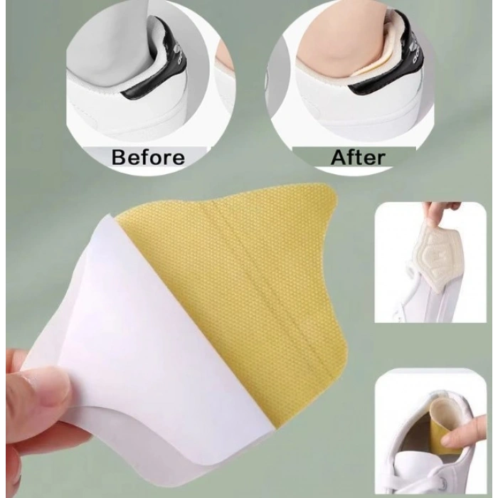 Nevamel Taç Şeklinde Topuk Vurma Önleyici 10 mm.