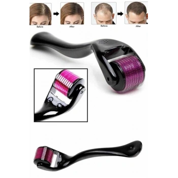 Nevamel Derma Roller Titanyum Uçlu 540 İğneli 1 Mm Saç Sakal Çıkarma Ve Cilt Bakım Masaj Aleti