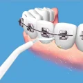 BUĞZ Power Floss Mekanik Diş Ve Ağız Temizleme Aleti ve Diş Beyazlatma Seti