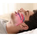 BUĞZ Rahat Uyku İçin Anti Snore Sleep Horlama Engelleyici Aparat Uyku Stoperi