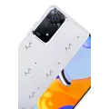BUĞZ Xiaomi Redmi Note 11 Pro Fiyonk Desenli Kapak - Desen 4