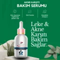 Genel Ürün Akne ve Siyah Nokta Karşıtı Serum Gözenek Sıkılaştırıcı Niacinamide Arbutin Cilt Serumu 30ml Phigo