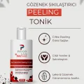Genel Ürün Gözenek Sıkılaştırıcı ve Canlandırıcı Tüm Ciltler Için Tonik 200 ML Nemlendirci Peeling Tonik Phigo