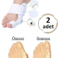 Genel Ürün 2li Atel Ayak Parmak Başparmak Düzeltici Kemik Çıkığı Düzleştirici Taraklı Ayaklar Için Aparat