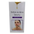 Sivilce Ve Akne Serumu 20 ML
