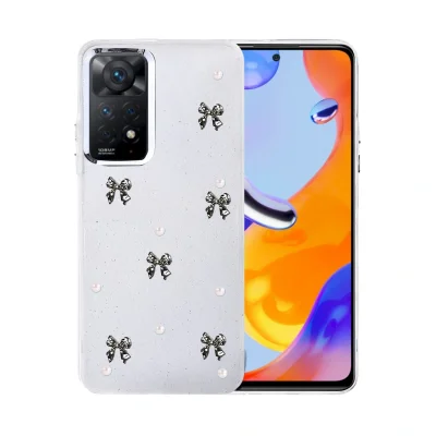 BUĞZ Xiaomi Redmi Note 11 Pro Fiyonk Desenli Kapak - Desen 8
