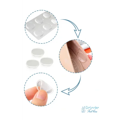 Genel Ürün 6lı Ayak Parmak ve Topuk Koruyucu Silikon Ped - Ayakkabı Vurma Önleyici