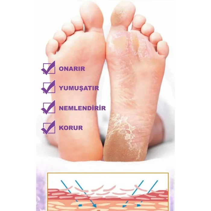 Ayak & Topuk çatlak Kremi, Nasır tedasivi, Ayak kokusu tedavisi, Nemlendirici 100 ML