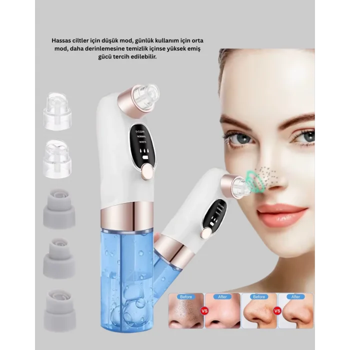 BUĞZ Ayarlanabilir Güç Seviyeli Vakumlu Siyah Nokta Temizleme Cihazı – Derin Gözenek Temizliği