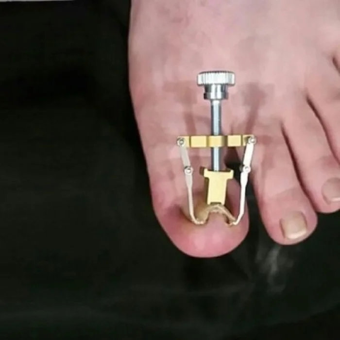 BUĞZ Batık Tırnak Düzeltme Aleti