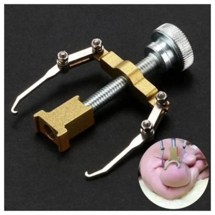 BUĞZ Batık Tırnak Düzeltme Aleti