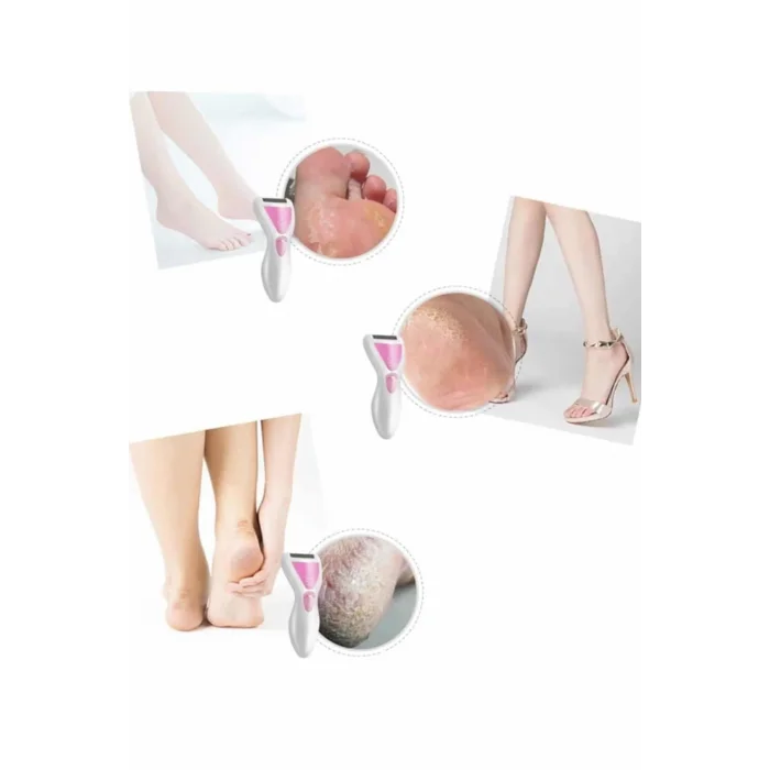 BUĞZ Epilatör Cihazı Epilasyon Aleti Çoklu Başlık Seçeneği Ayak Törpüsü