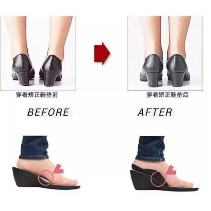  Esnek Düz Taban Düzeltici Topuk Yastığı