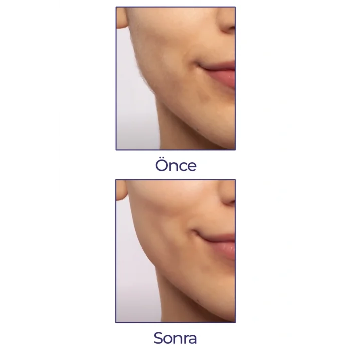 BUĞZ Flawless Yüz Tüy Temizleyici Şarjlı Epilasyon Aleti