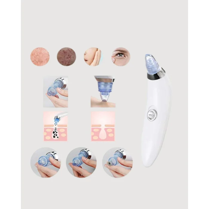 BUĞZ Güçlü Vakumlu Siyah Nokta Temizleyici – Cilt Pürüzlerini Gideren