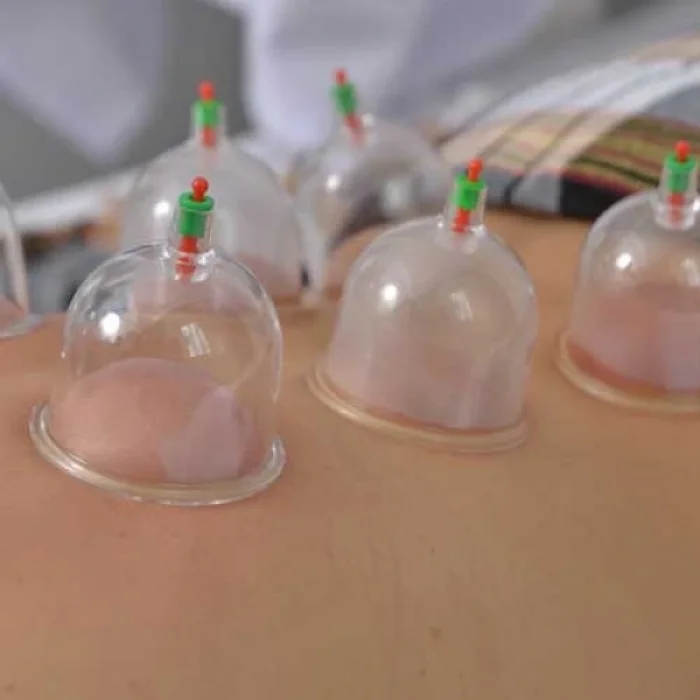 BUĞZ Hacamat Kupa Seti 6 Adet