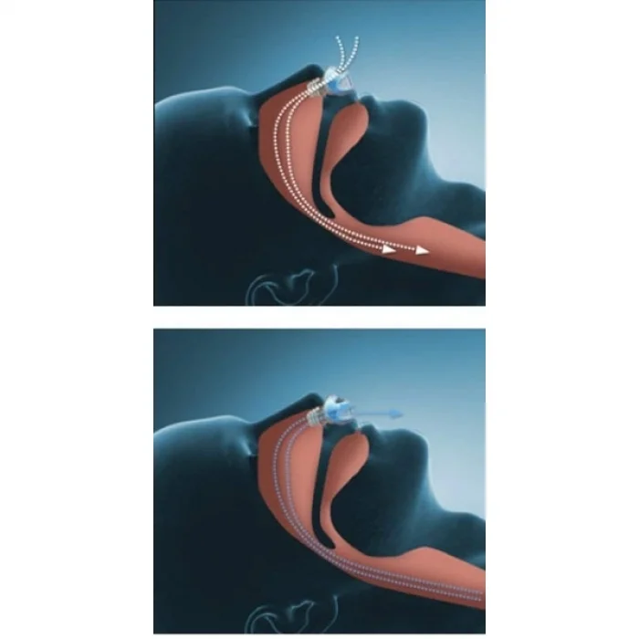 BUĞZ Horlama Önleyici Rahat Uyku Aparatı