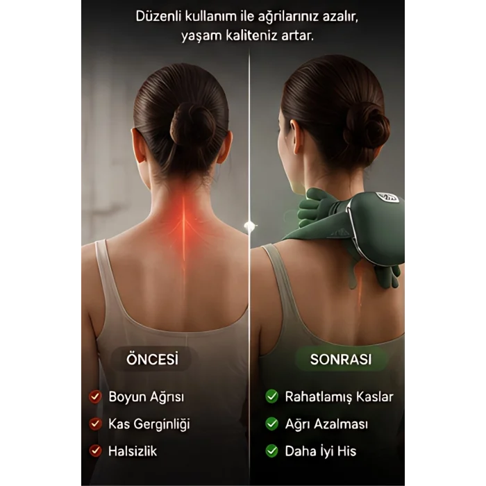 BUĞZ Kızılötesi Isıtmalı Avuç İçi Boyun Omuz Sırt Masaj Aleti Şarjlı 3D Yoğurma Etkili