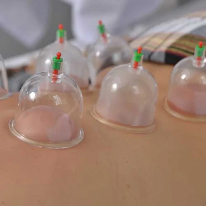 BUĞZ Kupa Çekme Hacamat Seti 6 Adet