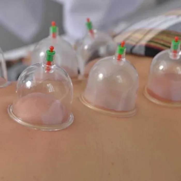 BUĞZ Kupa Çekme Hacamat Seti 6 Adet