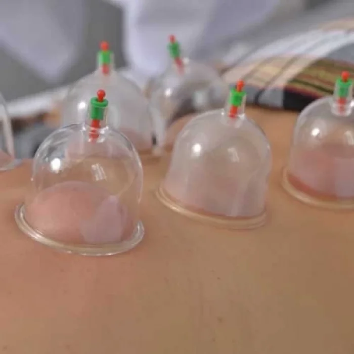  Kupa Çekme Hacamat Seti 6 Adet