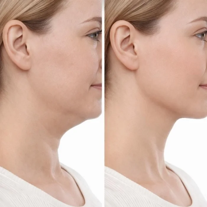 BUĞZ Lenfatik Drenaj Masaj Fırçası