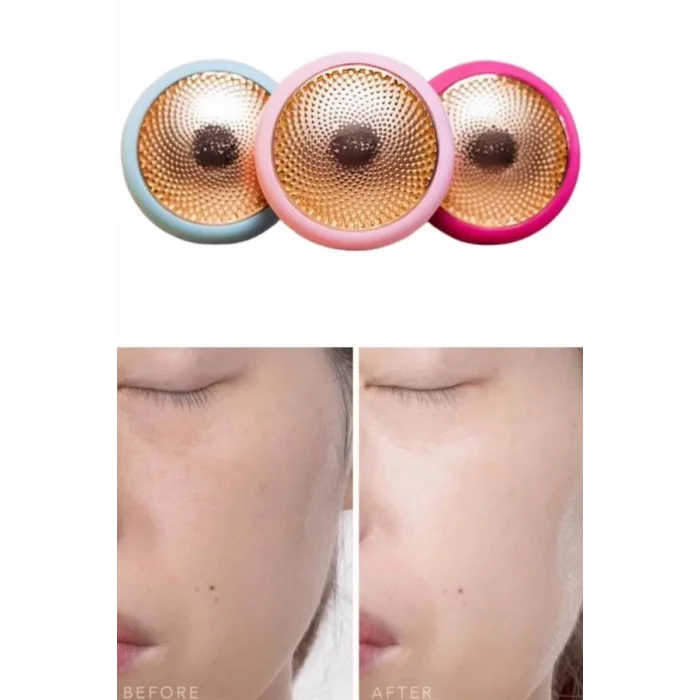  Mini Saç Derisi Masaj Aleti Led Işık Terapisi Cildi Yatıştırır ve Dengeler