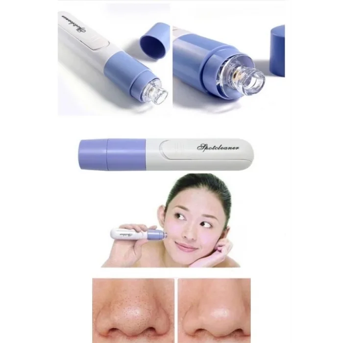 BUĞZ Pore Cleaner Vakumlu Yüz Temizleme Siyah Nokta Temizleme Cihazı - Lisinya