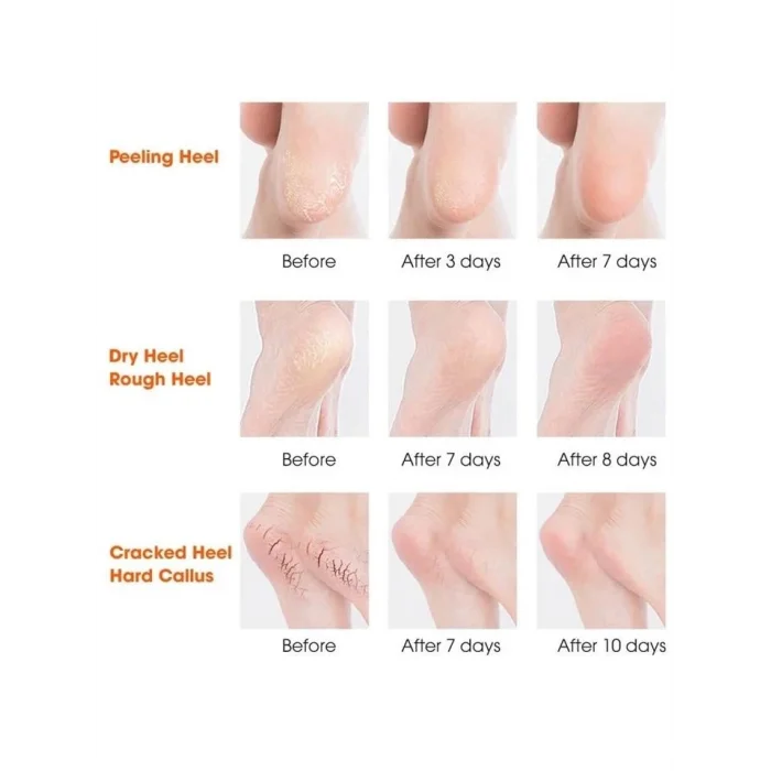 BUĞZ Silikon Topuk Nemlendirici Çorap - Lisinya