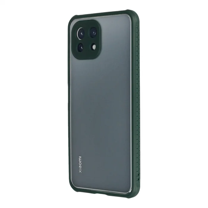 BUĞZ Xiaomi Mi 11 Lite Kılıf Miami Şeffaf Silikon - Koyu Yeşil