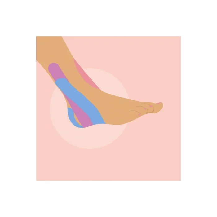 Genel Ürün Tape Kinesio Ağrı Bandı 5 Metre X 5 Cm Ten