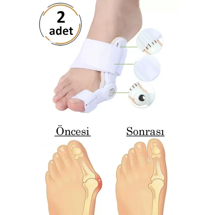 Genel Ürün 2li Atel Ayak Parmak Başparmak Düzeltici Kemik Çıkığı Düzleştirici Taraklı Ayaklar Için Aparat