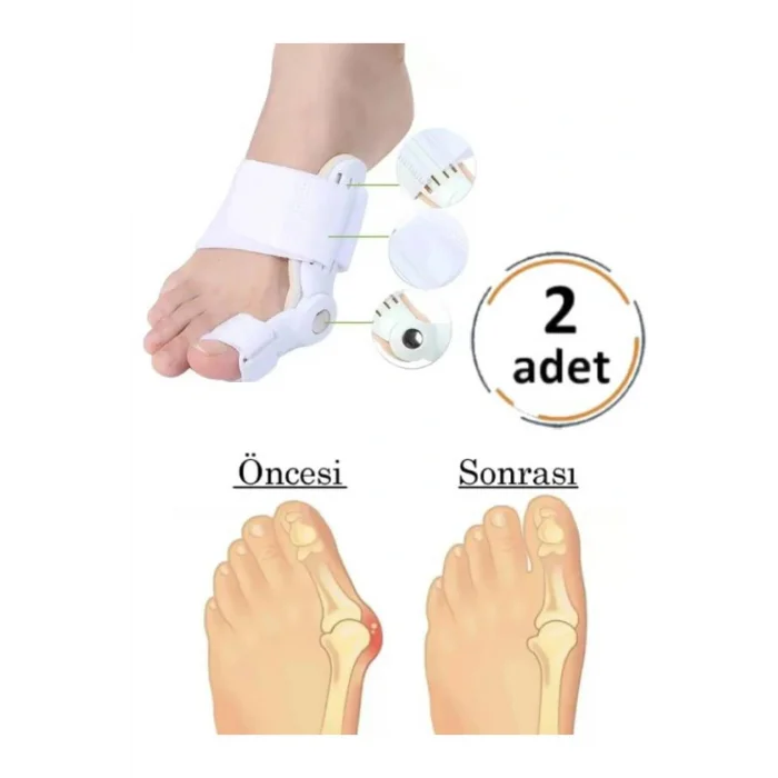 Genel Ürün 2li Atel Ayak Parmak Başparmak Düzeltici Kemik Çıkığı Düzleştirici Taraklı Ayaklar Için Aparat