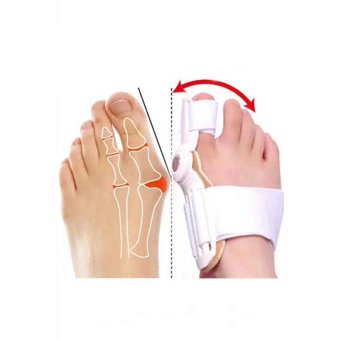 Genel Ürün Baş Parmak Kemik Düzeltici Başparmak Kemik Eğriliği Düzeltici Gece Ateli Atel Halluk Valgus