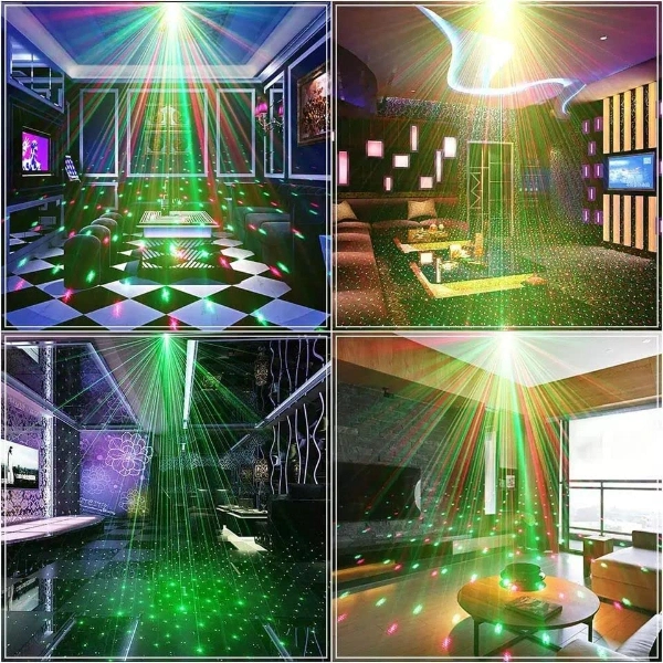 BUĞZ LAZER MAKİNESİ