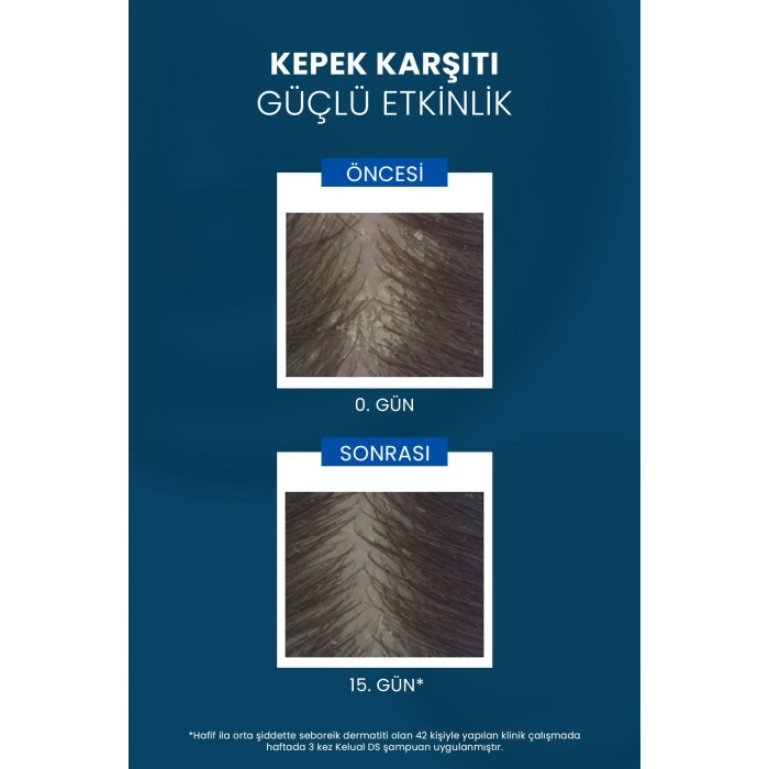 Ducray Kelual DS Şampuan 100 ml