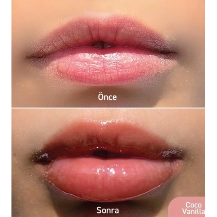 Herbaderm Parlak Dudak Balmı Coco Vanilya Aromalı 10 ml (Charm Hediyeli)