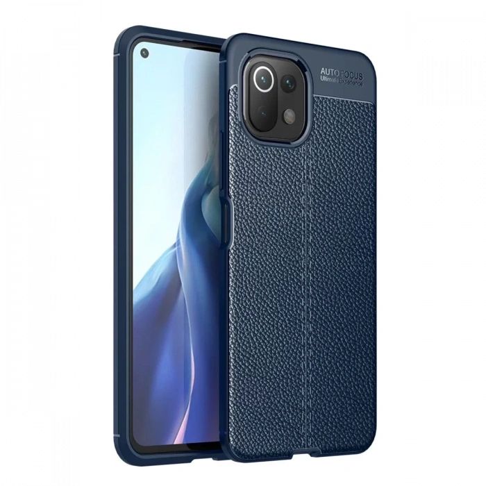 Xiaomi Mİ 11 Lite Kılıf Auto Focus Kapak - Lacivert
