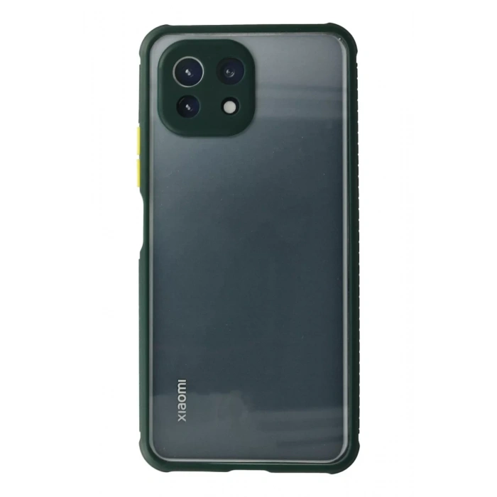 Xiaomi Mİ 11 Lite Kılıf Miami Şeffaf Silikon - Koyu Yeşil