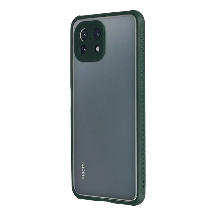 Xiaomi Mİ 11 Lite Kılıf Miami Şeffaf Silikon - Koyu Yeşil