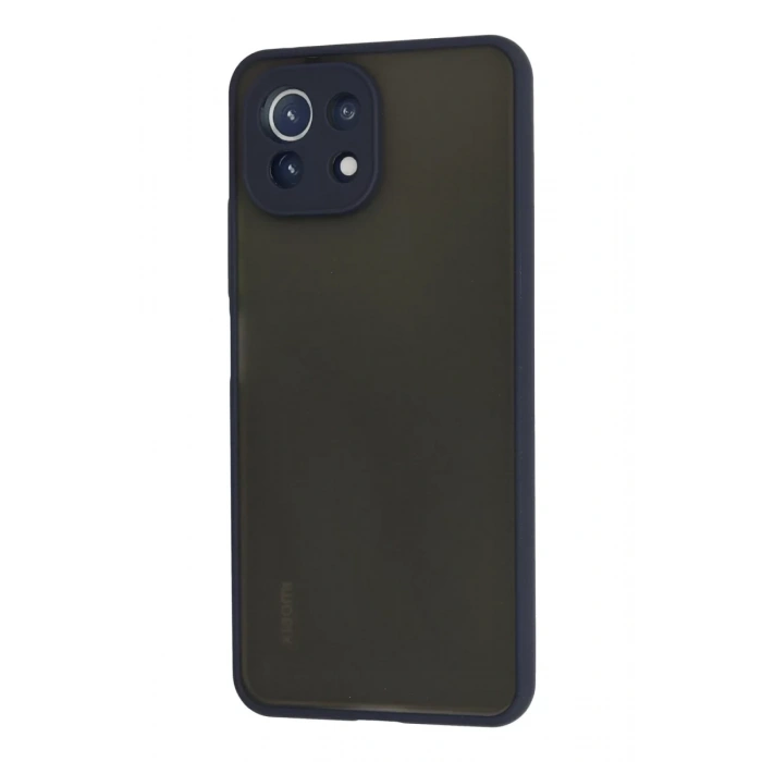 Xiaomi Mİ 11 Lite Kılıf Montreal Silikon Kapak - Lacivert