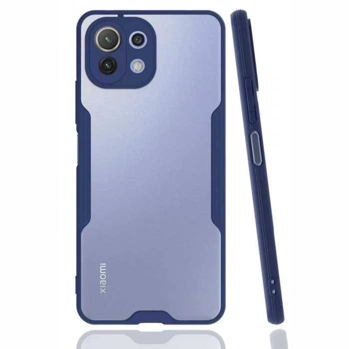 Xiaomi Mİ 11 Lite Kılıf Platin Silikon - Lacivert