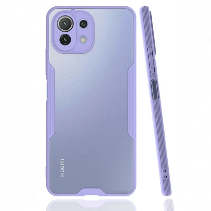 Xiaomi Mİ 11 Lite Kılıf Platin Silikon - Lila